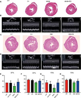 Aerobic Exercise Inhibited P2X7 Purinergic Receptors to Improve Cardiac Remodeling in Mice With Type 2 Diabetes